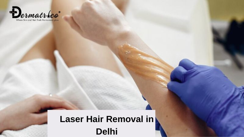 Say Goodbye to Unwanted Hair: The Confidence-Boosting Power of Laser Hair Removal